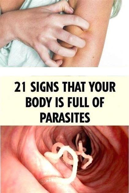 Dont Ignore These Early Symptoms Of Parasites In Your Body