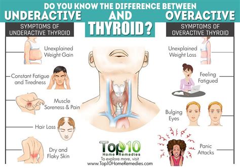 Difference Between Underactive And Overactive Thyroid Thyroid Disease