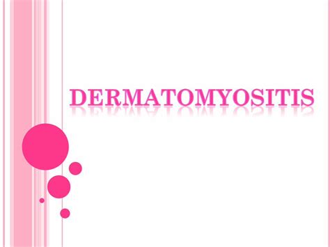 Ppt Dermatomyositis Persentasi Dokumen Tips