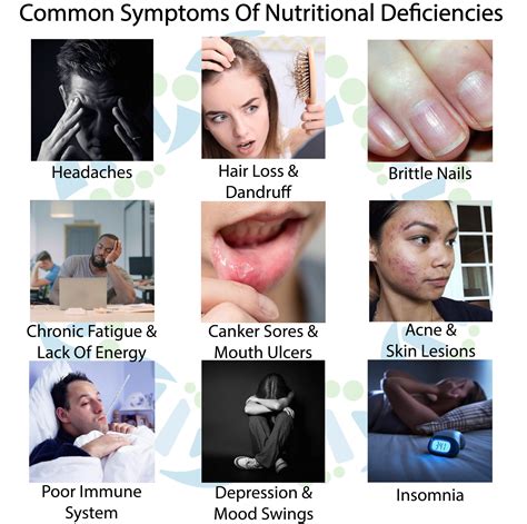 Nutritional Deficiency Diseases Symptoms Causes And Prevention Tips