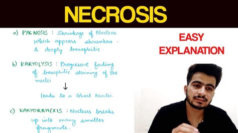 Necrosis Pathology Eoms Youtube
