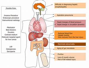 Diagram Of Liver Cirrhosis / If you've developed cirrhosis from alcohol abuse, stop drinking ... Cirrhosis  