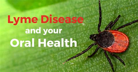The Connection Between Lyme Disease And Oral Health Our Dental Blog