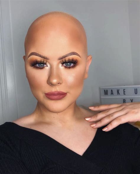 Make Up Artist Who Was Diagnosed With Alopecia At 16 And Tried To Cover Her Bald Spots With Dry