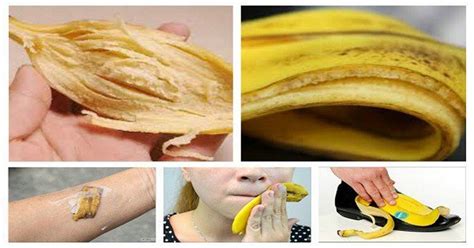 Voici 10 Façons Dutiliser Les Peaux De Banane Newsmag