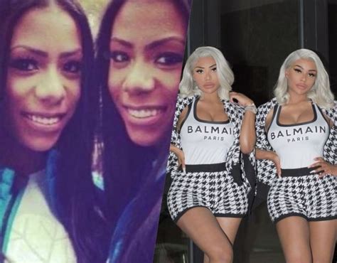 Clermont Twins Before And After Pictures How Does The Twins Look After