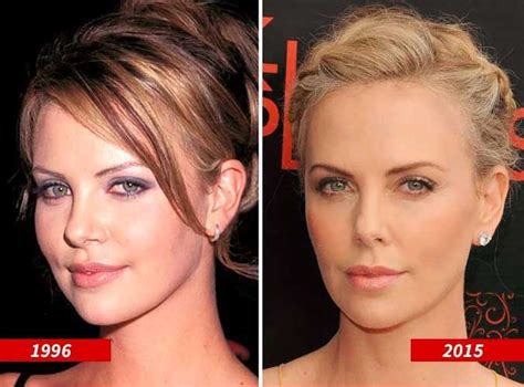Charlize Theron Plastic Surgery Nose Job Facelift Eyelid Surgical
