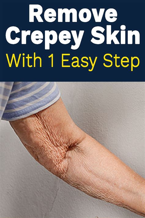 Bestio Incredible How To Fix Crepey Skin On Legs Naturally 2022