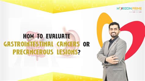 Know How To Evaluate Gastrointestinal Cancers And Precancerous Lesions