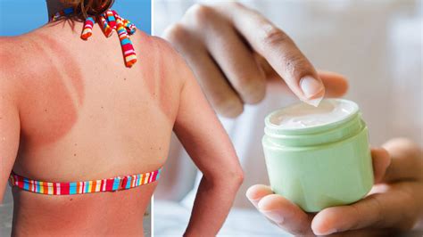 Ways To Treat Sunburn 7 Simple Solutions To Ease The Pain Heart
