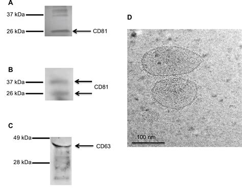 Figure From Neural Stem Cell Derived Exosomes Mediate Viral Entry