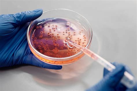 The Spread Of Candida Auris A Deadly Drug Resistant Fungus Has Become