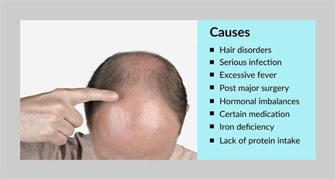 Hair Loss Baldness Causes Reasons Hair Loss Solutions Cures For