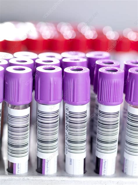 Blood Samples Stock Image C0010761 Science Photo