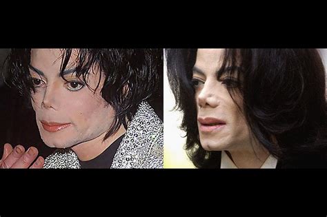 Michael Jackson Nose Falling Off