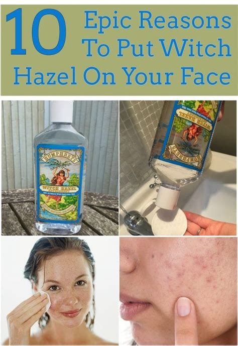Furthermore, this herb is a natural astringent. 10 Epic Reasons To Put Witch Hazel On Your Face & Skin