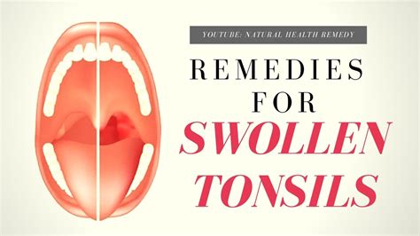 Swollen Tonsils Home Remedies For Swollen Tonsils How To Treat
