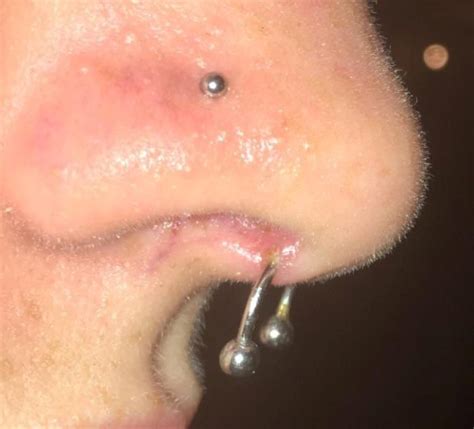 Piercing Rejection And Migration Causes And Treatments AuthorityTattoo