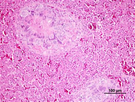 Accipiter Nisus With A Granulomatous Hepatitis Note The Presence Of