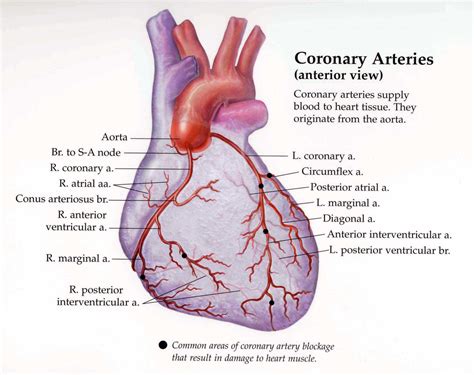 Coronary Arteries Anatomy Edoctoronline Com