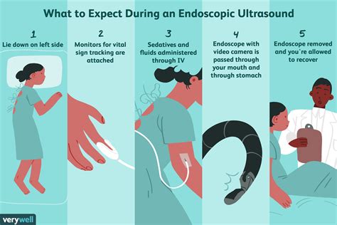 Endoscopic Ultrasound Eus Uses Procedure And Risks