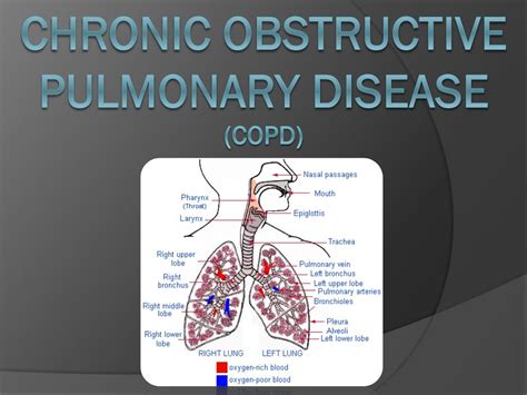 PPT Chronic Obstructive Pulmonary Disease COPD PowerPoint Presentation ID