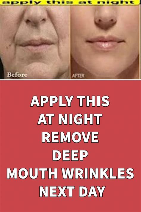 Apply This At Night Remove Deep Mouth Wrinkles Next Day Mouth Wrinkles Wrinkles Remedies Face