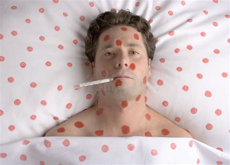 Man With Red Spots On Face And Body Stock Photo Image Of Suffering