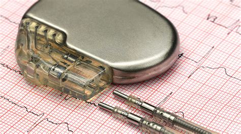 Cardiac Implants Catholic Health The Right Way To Care