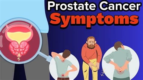 Prostate Cancer Symptoms Erectile Dysfunction Youtube
