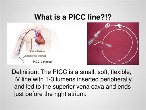 Picc Line Picture