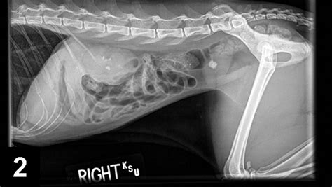 As children we learned that we need to drink our milk because we need calcium for strong bones and teeth. Calcium Oxalate Urolithiasis | Clinician's Brief