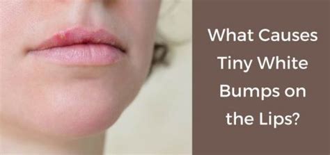 Bumps On Lips 9 Causes Home Remedies And Prevention Tips