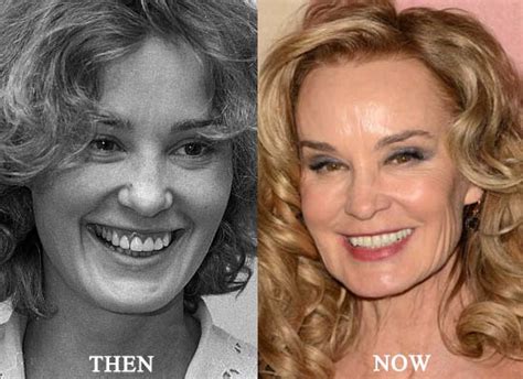 Jessica Lange Plastic Surgery Photo Before And After Celebrity