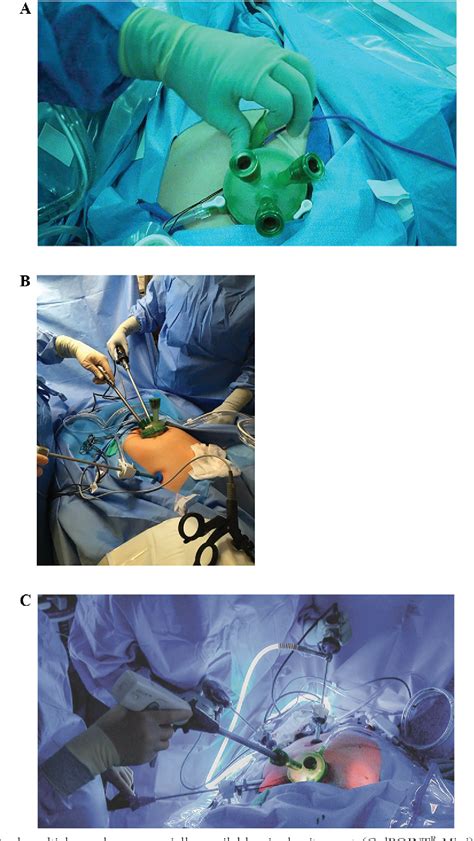 Figure 1 From Vaginal Natural Orifice Transluminal Endoscopic Surgery