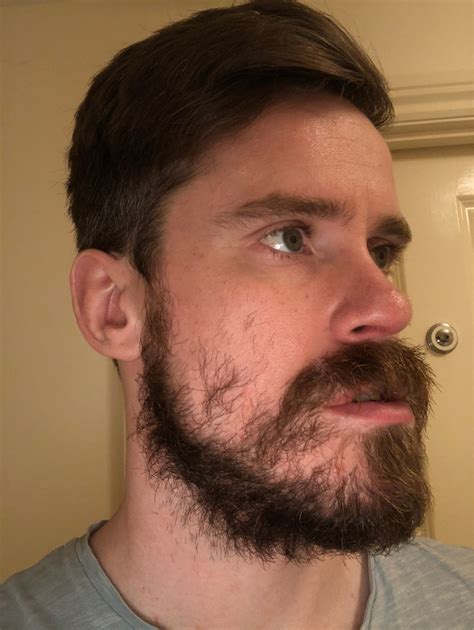 Patchy Beard Success Stories Before And After Photos Page 25 Beard