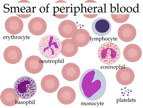 What Is Eosinophilic With Pictures