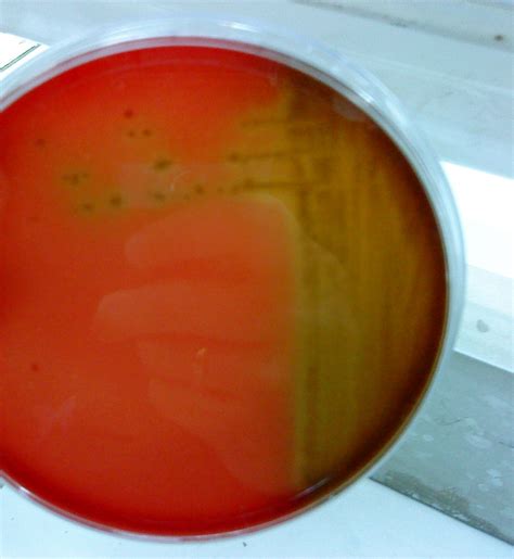 Hemolytic virulent colonies and nonvirulent colonies that show no zones of hemolysis when streaked on heart infusion agar containing 5% rabbit blood. hemolysis labs - DriverLayer Search Engine
