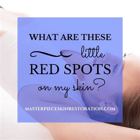 Why People Get Those Little Red Spots Called Cherry Angiomas