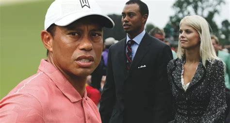 Was Tiger Woods Forced To Have Extensive Plastic Surgery After An Altercation With His Ex Wife