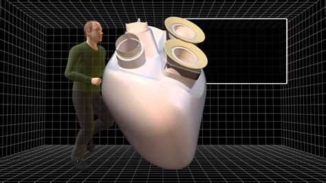 First Artificial Heart Implant Offers New Hope To Patients With Heart