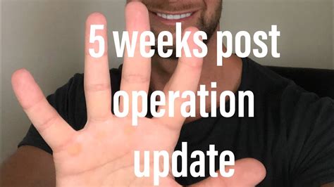 circumcision operation 5 week update youtube