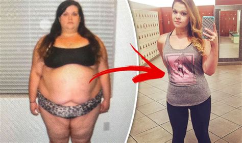 Obese Woman Shed Stone After Weight Loss Surgery But Then Her Jealous Husband Left Her