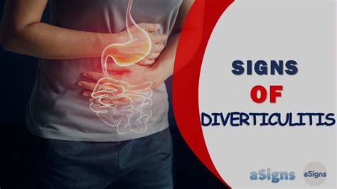 10 Signs Of Diverticulitis Youtube