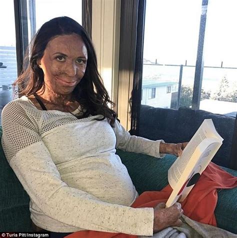 Burns Survivor Turia Pitt Shows Her Baby Bump On Instagram Daily Mail Online
