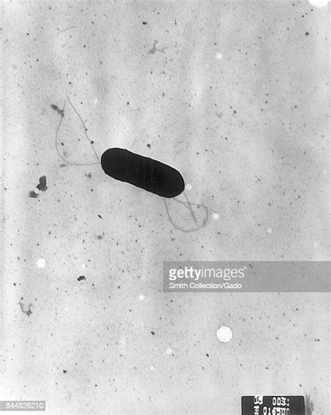 Listeria Monocytogenes Photos And Premium High Res Pictures Getty Images