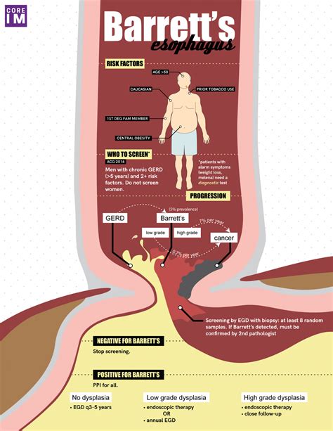 5 pearls on barrett s esophagus core im podcast