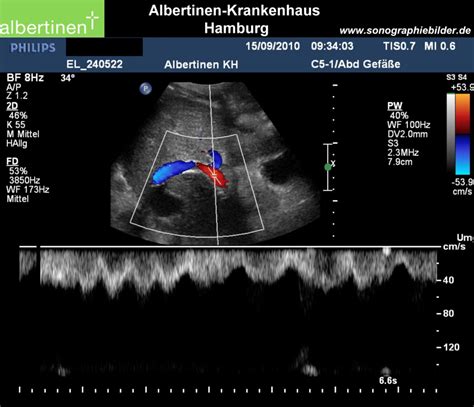 Tips Doppler Ultrasound Doccheck