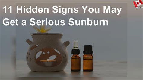 11 Hidden Signs You May Get A Serious Sunburn Youtube