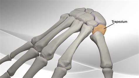 Arthrex Thumb Metacarpal Arthritis Repair With Cmc Mini Tightrope® System